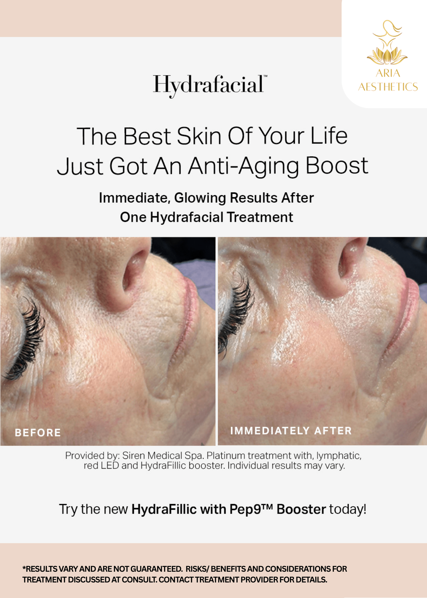 Hydrafacial Treatment before and after results Hydrafacial Treatment before and after results